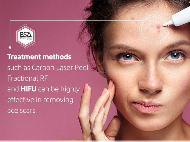 علاج حب الشباب باستخدام الطرق الطبيعية: دليل شامل ومحدث