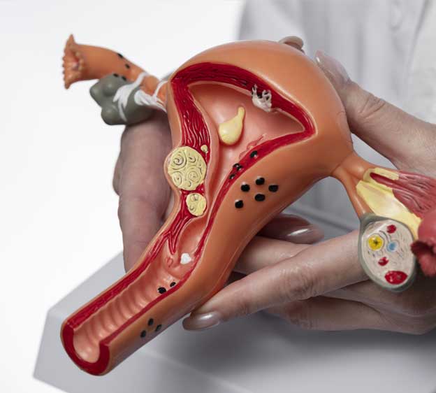 آلام الدورة الشهرية: فهم علمي متقدم ومعلومات حديثة تهم المرأة