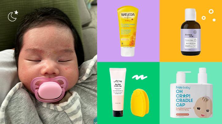 كيف تعتني بالإكزيما (التهاب الجلد التأتبي) عند الرضع؟