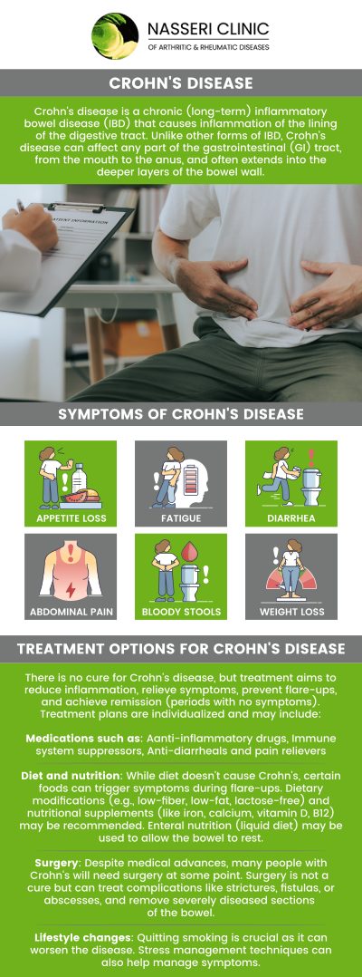 القولون العصبي: استكشاف شامل لهذا المرض المعقد والمتنوع
