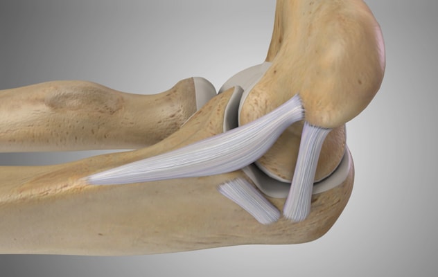 تمزق الأربطة: دراسة شاملة لأسبابه وتحدياته