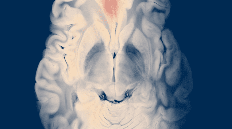 كيف تحسّن جودة السائل المنوي لدى الرجال يومياً بخطوات علمية؟