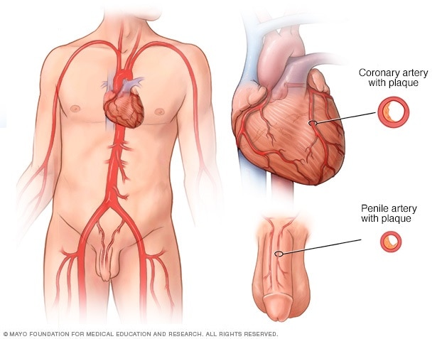 صحة القلب للرجال: فهم الواقع وتصحيح المفاهيم