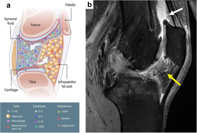الكولاجين للمفاصل: دليل شامل لتعزيز الصحة والمرونة