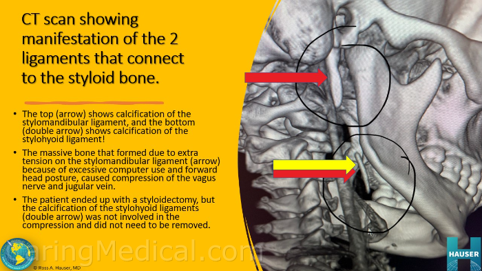 التهاب الأعصاب الطرفية: دليل شامل للمبتدئين