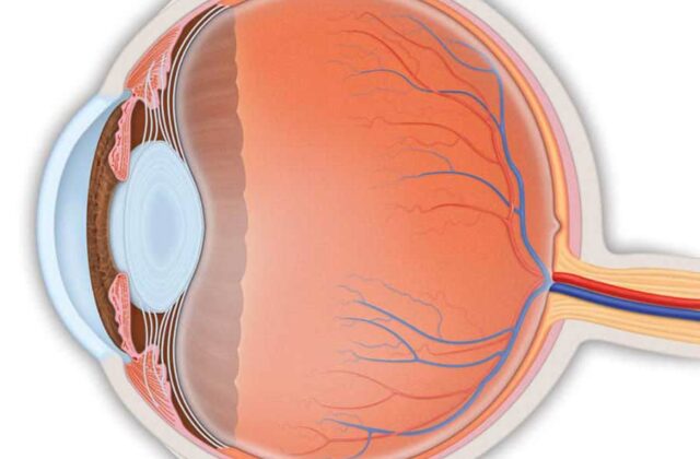 المياه الزرقاء (الجلوكوما): فهم شامل لأمراض وأعراض التصنيف