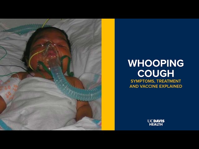 السعال عند الأطفال: دليل شامل لفهم أسبابه وطرق التعامل معه