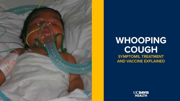 السعال عند الأطفال: فهم جديد وتطورات حديثة